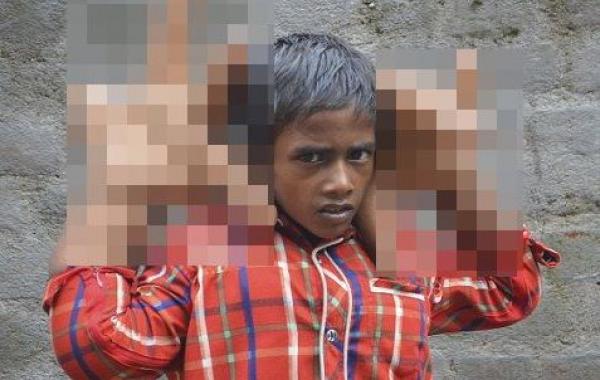 Kaleem India hands, Калим Кэлим гигантские руки