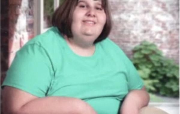Hannah Wilkinson Prader-Willi syndrome, Ханна Уилкинсон синдром Прадера-Вилли