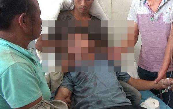 Металлический лом насквозь пробил голову китайцу, но тот чудом остался жив