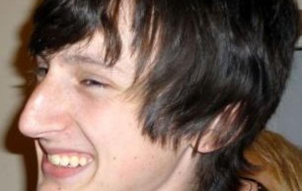 Лицо парня до и после пластической операции по уменьшению носа