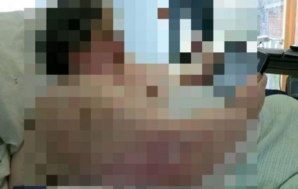 x ray fat person, рентген 400 кг, кейт мартин, x ray keith martin