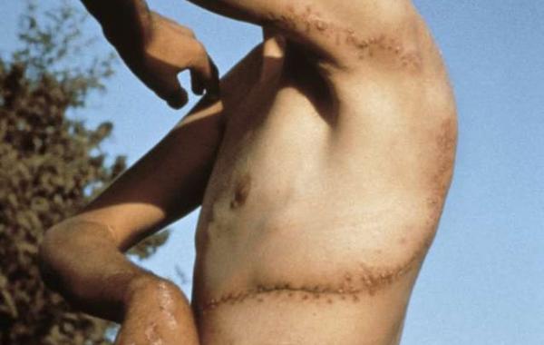 нападение акулы на человека, истории акула напала