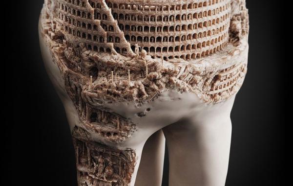 Колизей на зубе или как красиво показать кариес