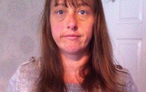 аллергическая реакция на краску для волос. женщина аллергия на краску для волос, после аллергии на краску для волос