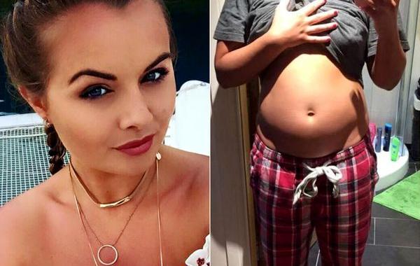 до и после вздутия живота, вздутие живота фото, сильное вздутие живота фото