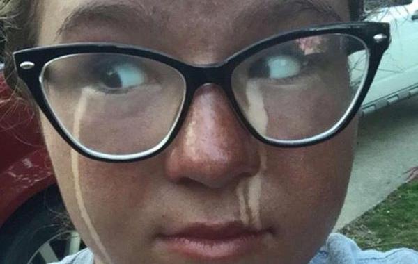 случаи с автозагаром, неудачное использование автозагара