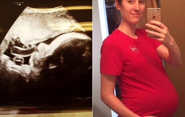 обратилась в суд забрать плаценту, постановление суда чтобы забрать плаценту, не смогла забрать плаценту