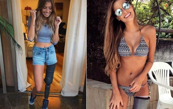 Паола Антонини, Paola Antonini, модель с ампутированной ногой, модель без ноги