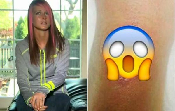 почему нельзя носить резинку для волос на руке, инфекция резинка для волос на руке, инфекция повязка для волос на руке