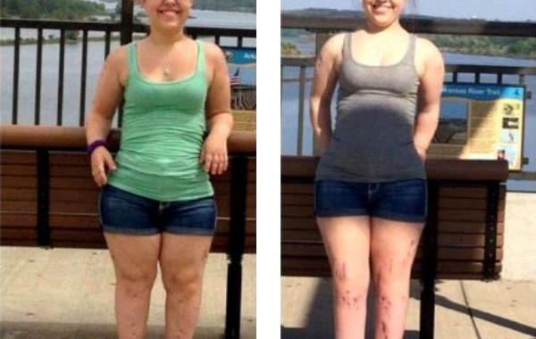 жуткие хирургические операции, пугающие операции