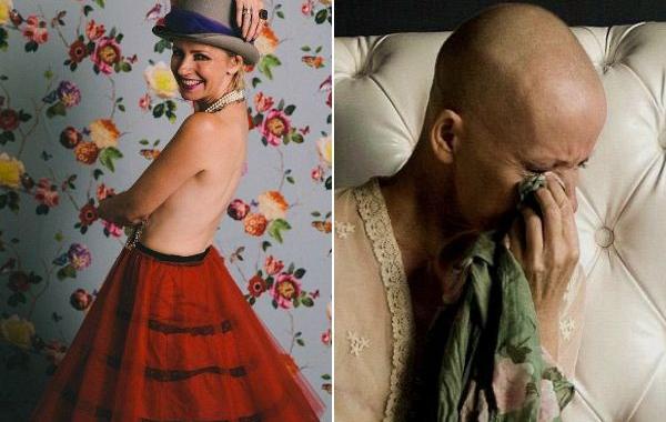 фотосессия после двойной мастэктомии