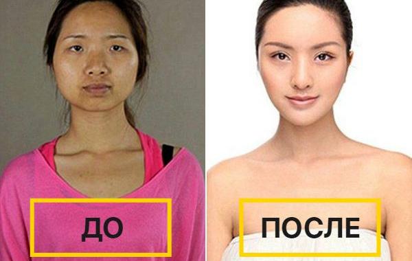 китаянки после пластических операций в Южной Корее, китаянки до и после пластических операций