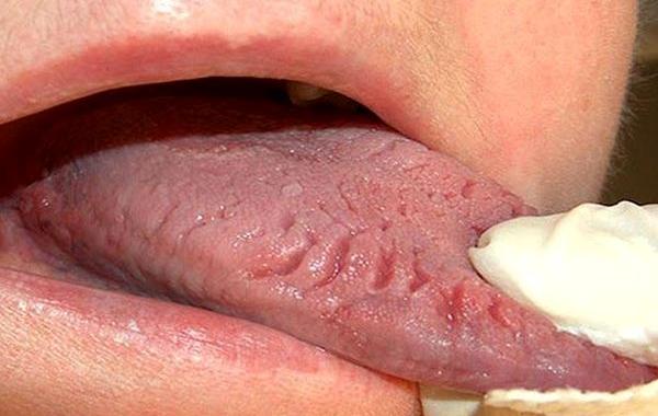 безумные медицинский препараты в истории, безумные медицинские процедуры в истории 