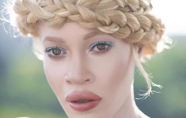 афроамериканская модель альбинос, Диандра Форрест, Diandra Forrest, чернокожая модель альбинос
