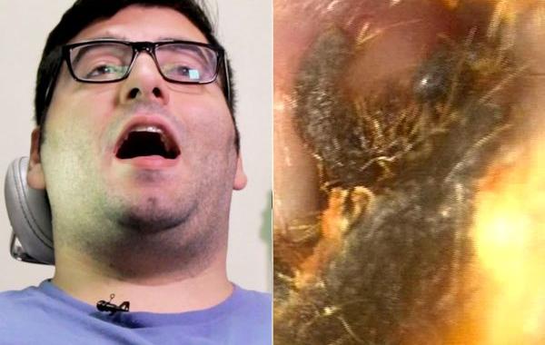 чистят уши видео, чистка ушей первый раз в жизни, люди очистили уши первый раз в жизни