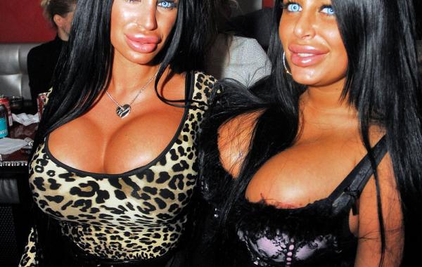 Жертвы пластической хирургии из Сербии ,Тияна Джуричич (Tijana Ðjuričić) и Саня Жожич (Sanja Jojić) 