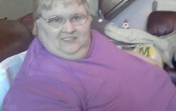 женщина похудела и обзавелась мошонкой, Полина Мол Гиббонс, Pauline Mole Gibbons, My Baggy Body 