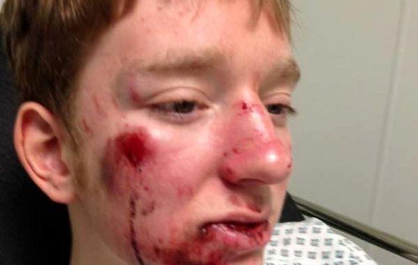 женщина сбила велосипедиста, женщина сбила подростка на велосипеде, женщина отказалась помочь велосипедисту