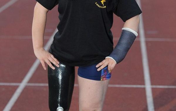 Школьница просит ампутировать ей ногу, Даниэль Брэдшоу, Danielle Bradshaw