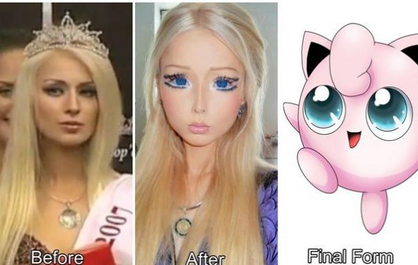 звёзды до и после пластических операций, в кого превращаются звёзды, любители пластических операций 