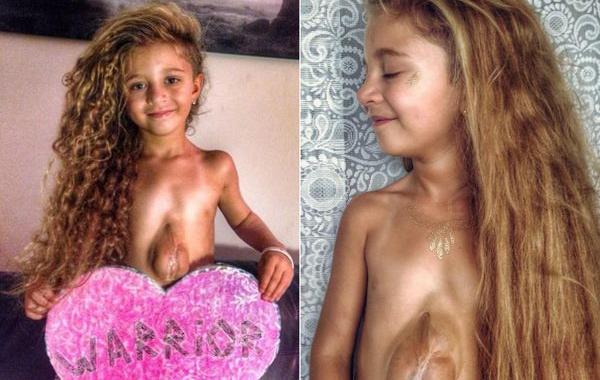 Вирсавия, Вирсавия Борун-Гончарова, Дари Борун, девочка с открытым сердцем, родилась сердце за пределами груди