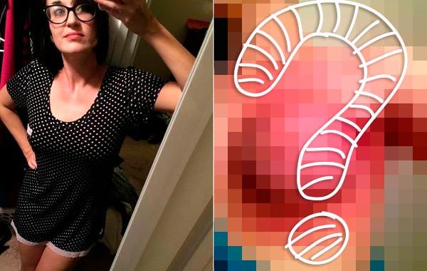 Джен Атлер, Jenn Atler, реальные фото борьбы с раком груди, фото реальной борьбы с раком груди