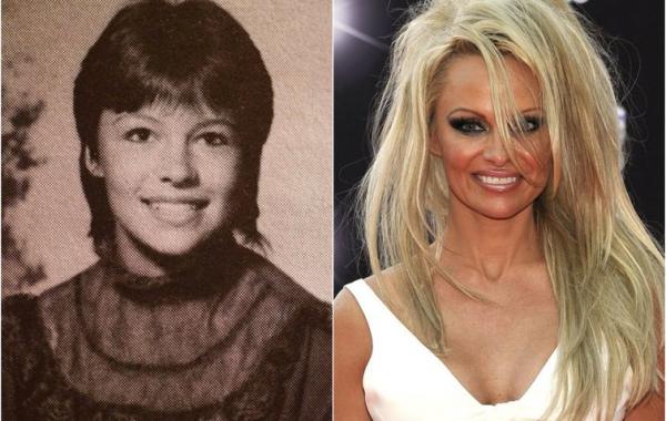 Современные фотографии звезд Голливуда до и после пластических операций