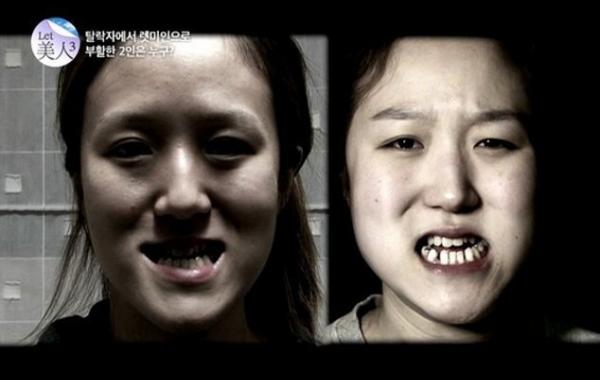 Жутковатые близняшки из Кореи до и после пластической операции