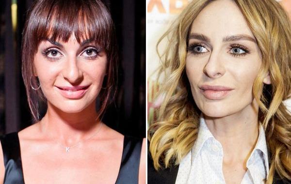 российские звёзды которые изменились до неузнаваемости, пластические операции звёзд 