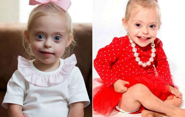 2-летняя модель с синдромом Дауна, Конни-Роуз Сиборн, Connie-Rose Seabourne