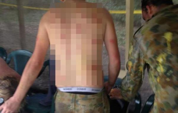 последствия игры в пейнтбол, что бывает после игры в пейнтбол