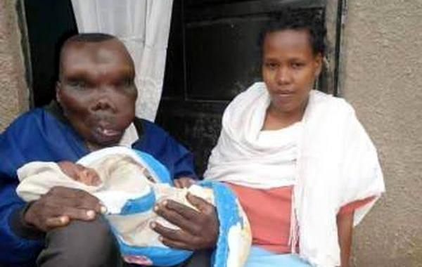 Годфри Багума,Godfrey Baguma, самый уродливый человек Угадны, уродливый человек стал отцом в восьмой раз