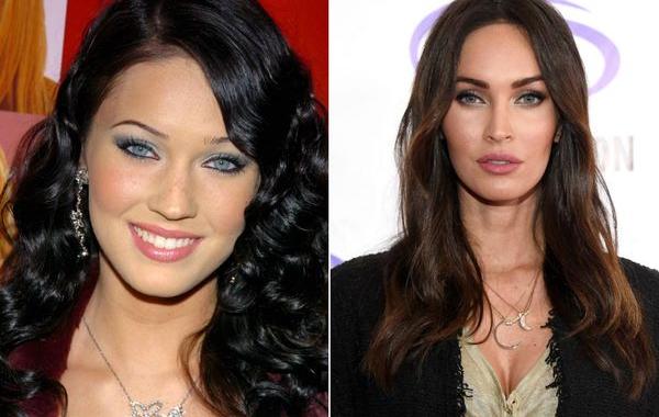 пластические операции, звёзды до и после пластики