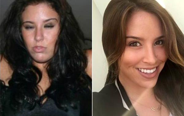 до и после того как бросили пить, сравнительные снимки бросивших принимать алкоголь