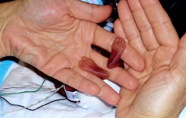 выжившие дети 7 историй выживания младенцев