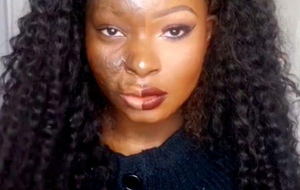 Девушка с ожогами стала визажистом, Шалом Нчом, Shalom Nchom