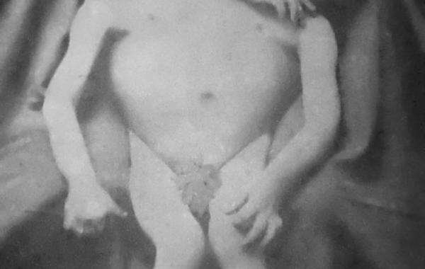 Любопытные и пугающие истории о знаменитых сиамских близнецах