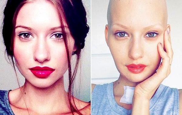 Елизавета Блухова,Elizaveta Bulokhova, сделать аборт рак челюсти, модель рак челюсти сделать аборт