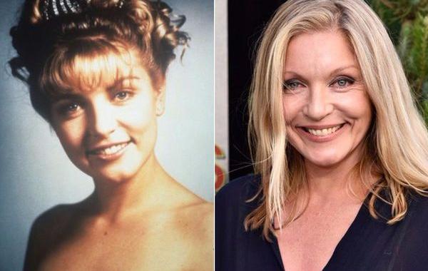 пластические операции актрис твин пикса, твин пикс 25 лет спустя