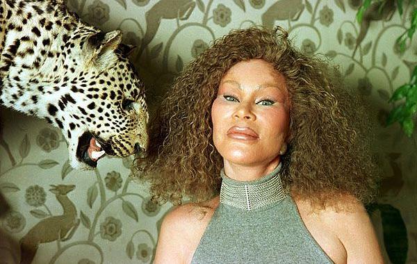  Джоселин Вайлд - жертва пластической хирургии