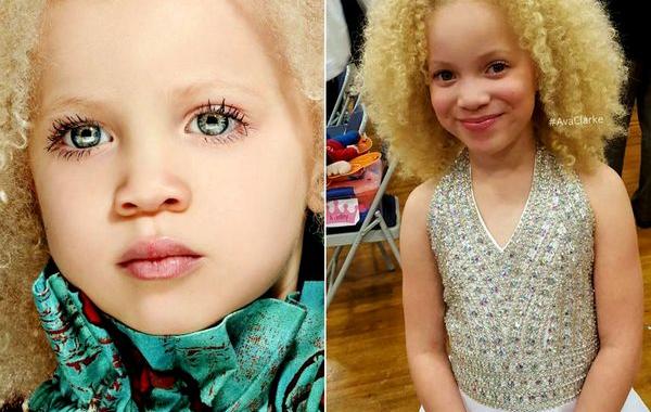 Ава Кларк, Ava Clarke, девочка-альбинос ставшая моделью