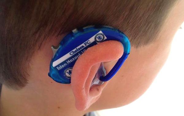 слуховой аппарат с супергероями, мама придумала как украсить слуховой аппарат, Сара Айверми, Sarah Ivermee