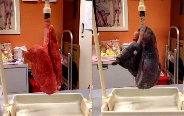 здоровые легкие и легкие курильщика, работа здоровых легких и курильщика