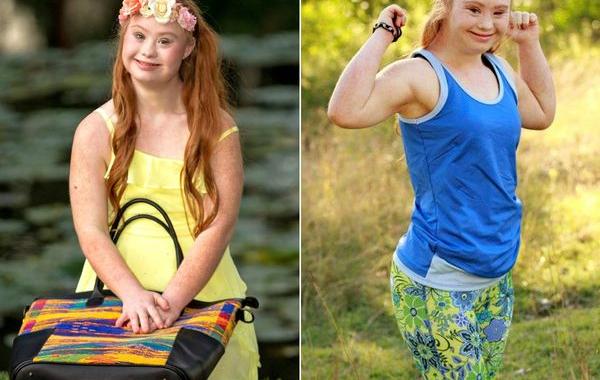 модель с синдромом Дауна, Маделин Стюарт, Madeline Stuart