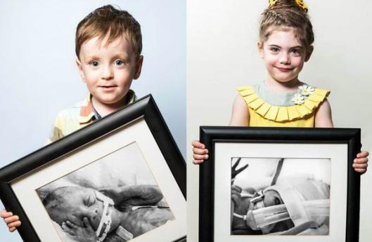 преждевременные, недоношенные дети фото сразу после рождения, недоношенные дети держат свои фото после рождения