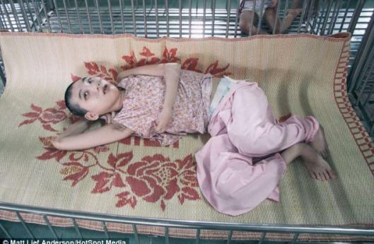 Последствия использования Agent Orange во Вьетнаме