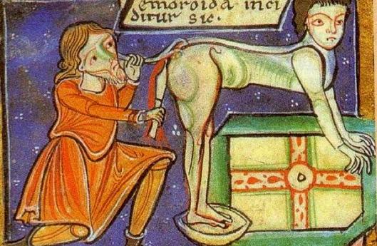 пугающие медицинские процедуры прошлого, операции средневековья